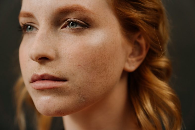 Skincare untuk Menghilangkan Bekas Jerawat