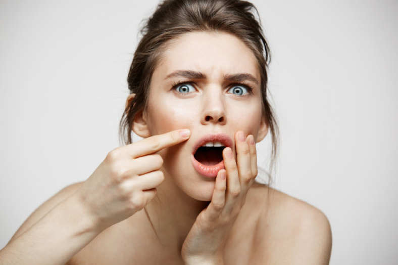 Rekomendasi Skincare untuk Menghilangkan Whitehead yang Aman