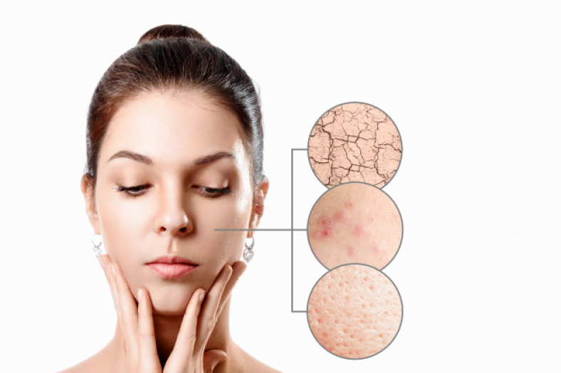 skincare untuk wajah bruntusan