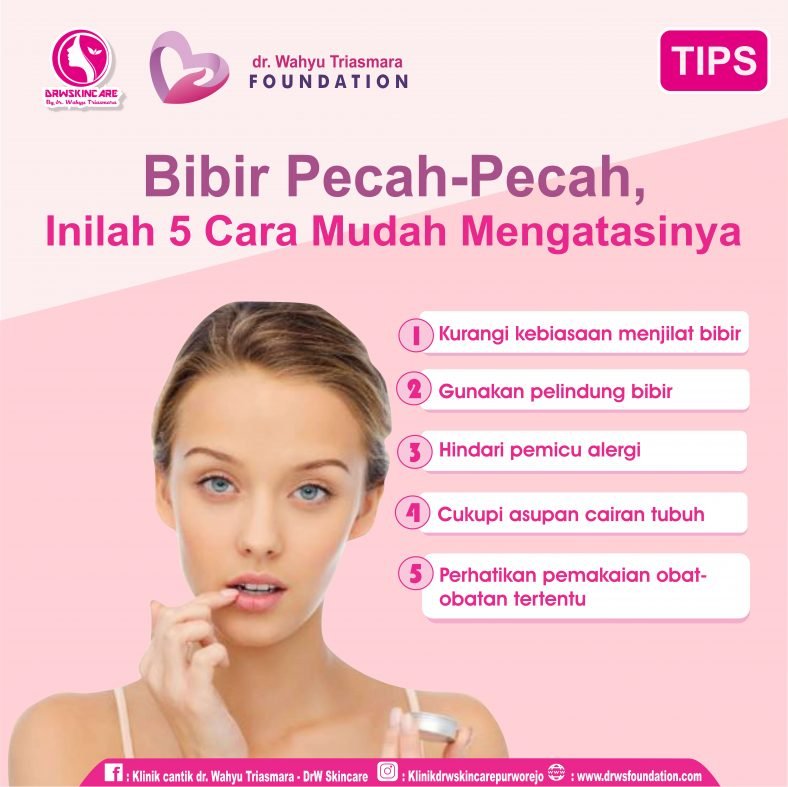 Bibir Pecah-Pecah, Inilah 5 Cara Mudah Mengatasinya