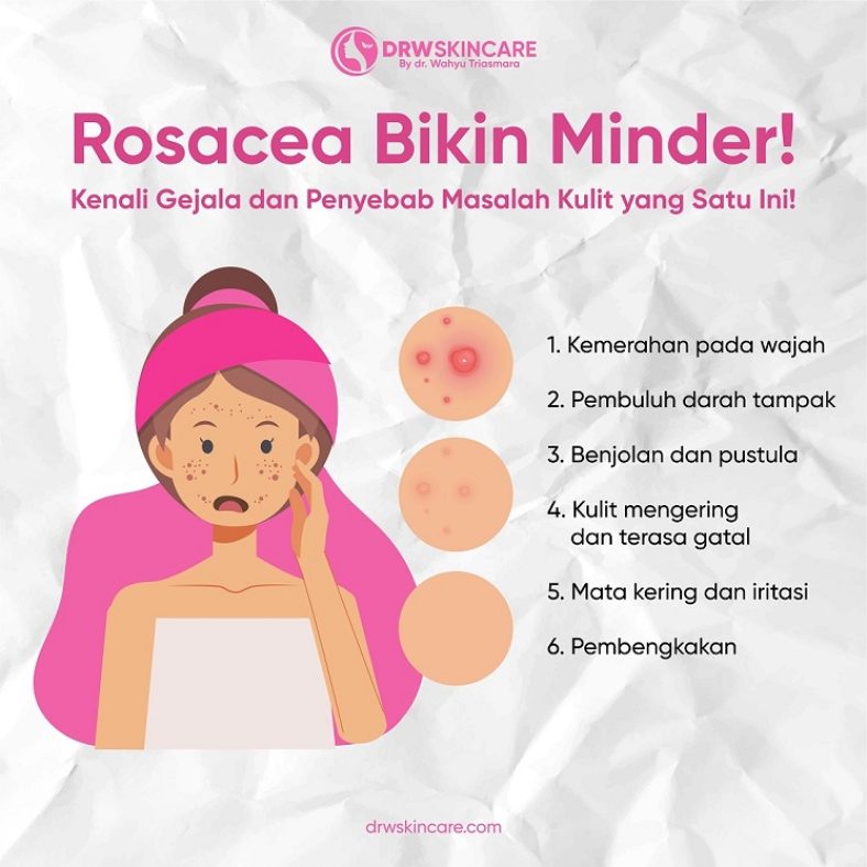 Rosacea Bikin Minder! Kenali Gejala dan Penyebab Masalah Kulit yang Satu Ini!