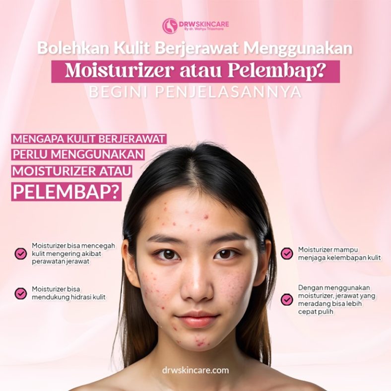 Bolehkan Kulit Berjerawat Menggunakan Moisturizer atau Pelembap? Begini Penjelasannya